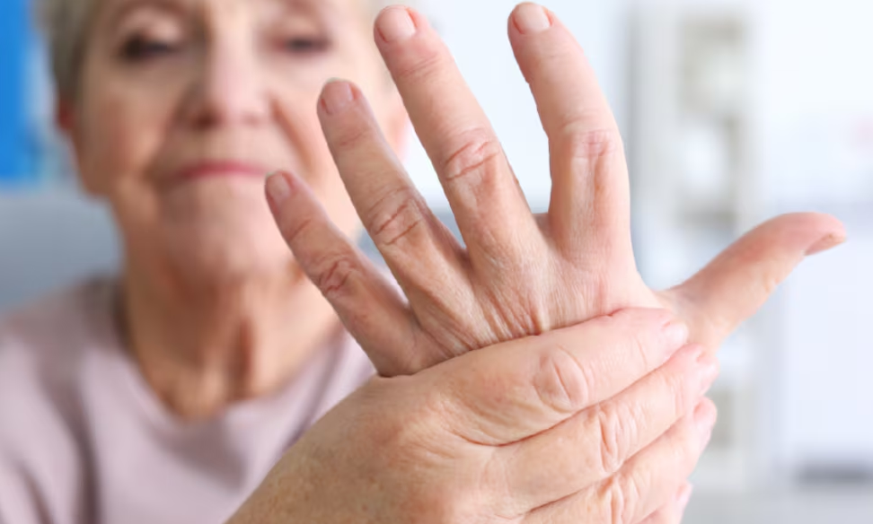 Tratamiento Artritis Reumatoidea en el Hospital Italiano